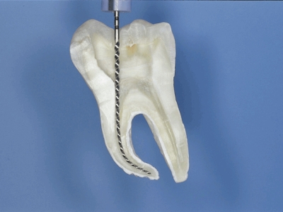Endodontie Zahnarztpraxis Dr. Wessling
